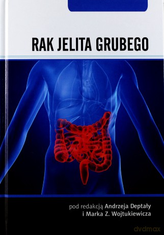 Rak jelita grubego [KSIĄŻKA]