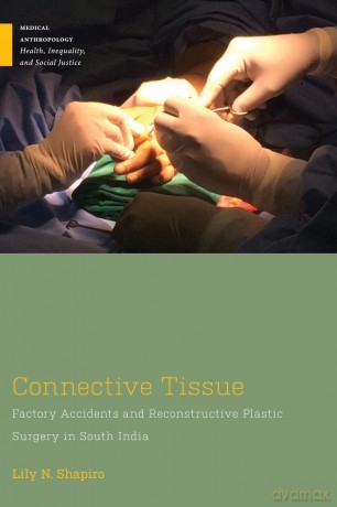 Connective Tissue: Factory Accidents and Reconstructive Plastic Surgery in South India (Medical Anthropology) - Lily N. Shapiro [KSIĄŻKA]