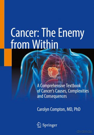 Cancer: The Enemy from Within: A Comprehensive Textbook of Cancer's Causes, Complexities and Consequences - Carolyn Compton [KSIĄŻKA]
