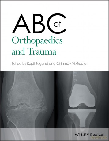 ABC of Orthopaedics and Trauma: 257 (ABC Series) - Kapil Sugand [KSIĄŻKA]