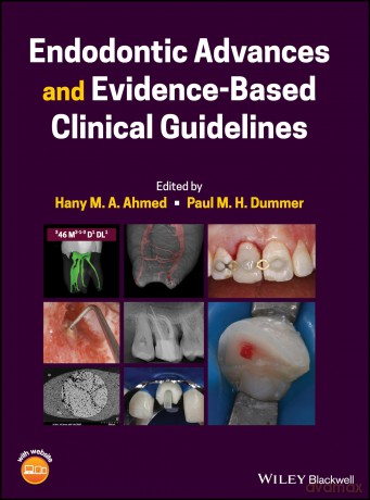 Endodontic Advances and Evidence-Based Clinical Guidelines - Hany M. A. Ahmed [KSIĄŻKA]