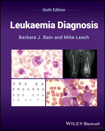 Leukaemia Diagnosis - Barbara J. Bain [KSIĄŻKA]
