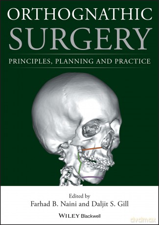 Orthognathic Surgery: Principles, Planning and Practice - Farhad B. Naini [KSIĄŻKA]