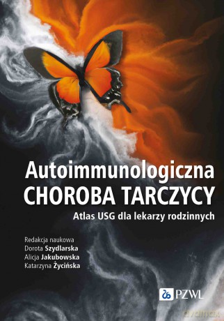 Autoimmunologiczna choroba tarczycy [KSIĄŻKA]
