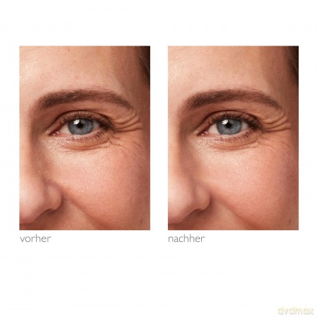 Alcina Rosé Effect Eye Cream (Eye Cream) 15 ml