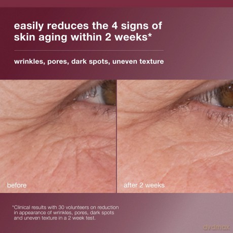 Dermalogica Skin serum against wrinkles Dynamic Skin Retinol (High-Dose Wrinkle Serum) 30 ml