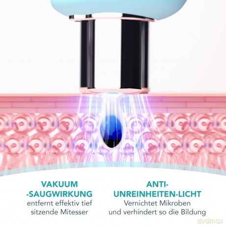 FOREO KIWI Vacuum device for cleaning pores