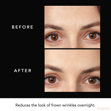 FOREO Microneedling Anti-Wrinkle Hyaluronic Acid Patches FAQ (Microneedling Anti-Wrinkle Hyaluronic Acid Patches) 3 pcs