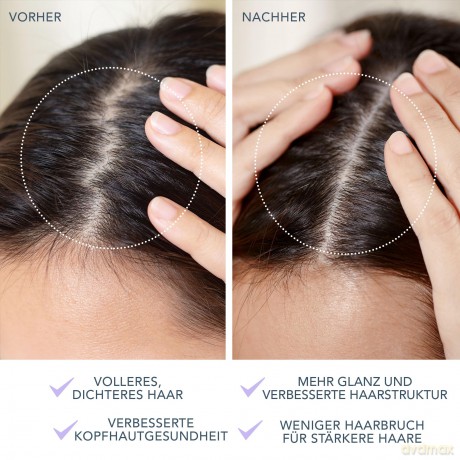 FOREO Scalp massager 2 in 1 LUNA 4 hair - Variant: Lavender