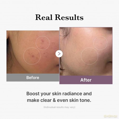 Medicube AGE-R Double-Layer Milk Toner (Glutathione Glow Toner) 140 ml