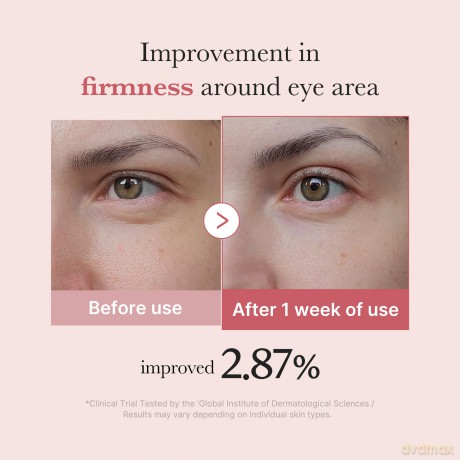 Medicube Anti-aging eye cream PDRN Pink (Peptide Eye Cream) 30 ml