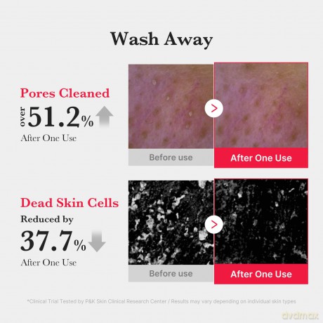 Medicube Cleansing foam against imperfections for oily and problematic skin Red Foam Cleanser 120 ml