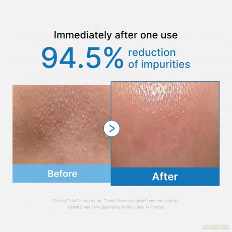 Medicube Cleansing skin oil Zero Pore (Blackhead Deep Cleansing Oil) 205 ml