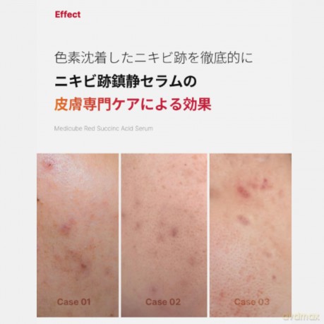 Medicube Exfoliating serum for problematic skin Red Succinic Acid (Serum) 30 ml