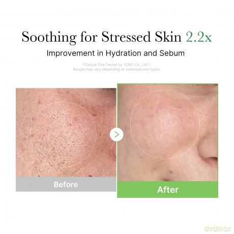 Medicube Exosome Soothing Face Cream (Cica Cream) 50 ml