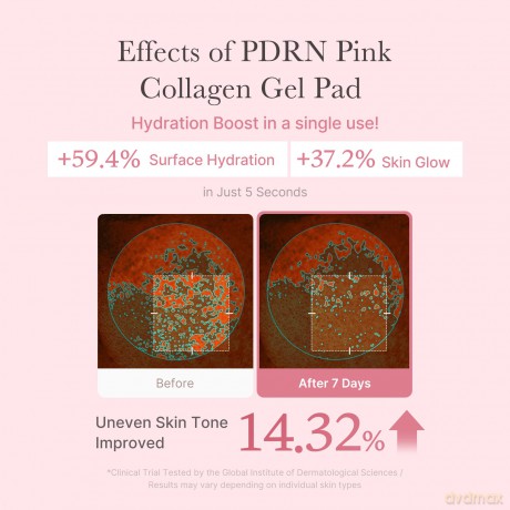 Medicube PDRN Pink Collagen Toning Gel Toner Pads (70 pcs)