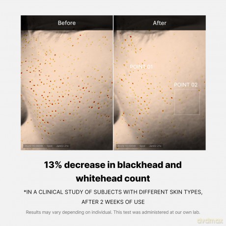 Medicube Zero Pore Revitalizing Face Serum (One Day Serum) 30 ml