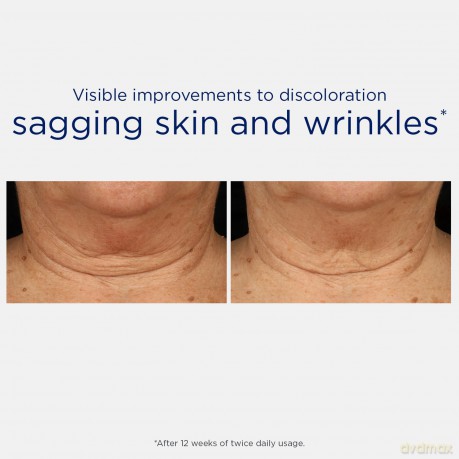 NeoStrata Skin Active Firming Triple Firming Neck Cream 80 g