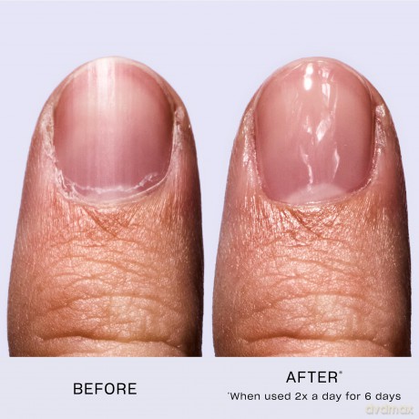 OPI Nail Envy Nail Strengthener 15 ml - Shade: All Night Strong