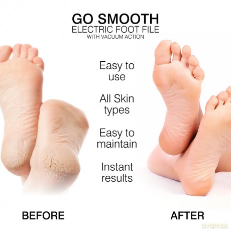 Rio-Beauty Go Smooth electric foot file with vacuum suction