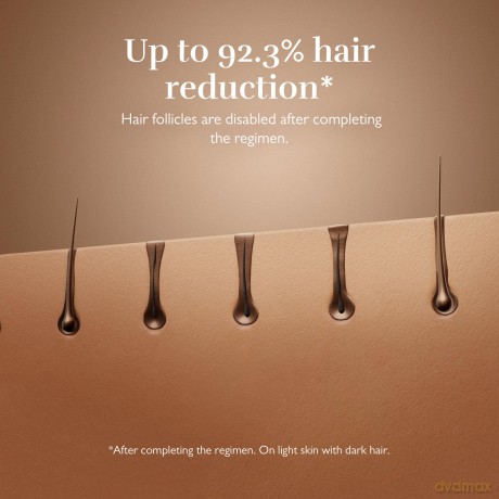 Silk'n Silk´n 7 pulsed laser epilator with flexible Champagne head (600,000 pulses)