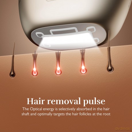 Silk'n Silk´n 7 pulsed laser epilator with flexible Champagne head (600,000 pulses)