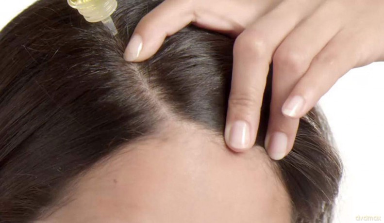 Simply Zen Anti-hair loss tonic (Stimulating Scalp Lotion) - Volume: 8 x 6 ml