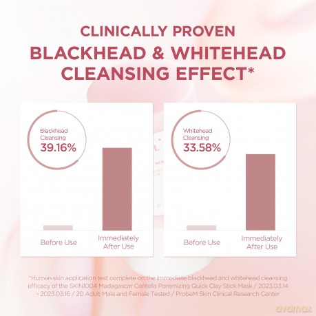 SKIN1004 Madagascar Centella Purifying Clay Stick Mask (Poremizing Quick Clay Stick Mask) 27 g