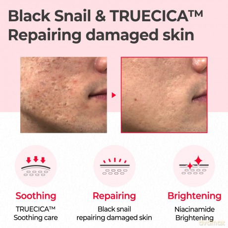 Some By Mi Snail Truecica Miracle Repair Toner 150 ml