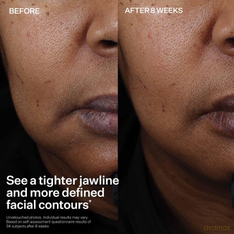 StriVectin Tighten & Lift Peptight? (Face Lift Serum) 30 ml
