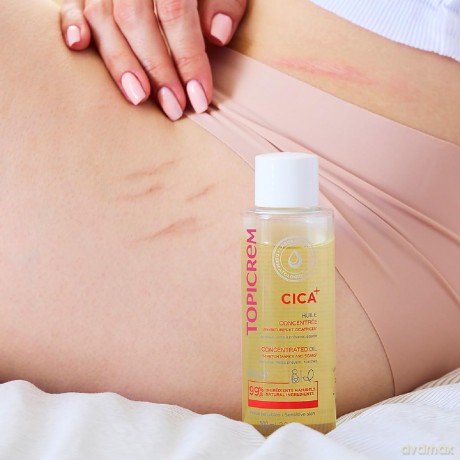 Topicrem Concentrated oil for stretch marks and scars CICA+ (Concentrated Oil for Stretch Marks and Scars) 100 ml