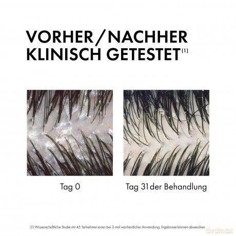 Vichy Shampoo and conditioner 2 in 1 Anti Dandruff DS (Dermatological Conditioning Shampoo) 400 ml