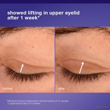 Dermalogica Phyto Nature Lifting Eye Cream 15ml