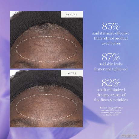 KORA Organics Plant Stem Cell Retinol Alternative Moisturizer 15ml