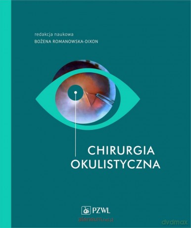 Chirurgia okulistyczna - Bożena Romanowska-Dixon [KSIĄŻKA]