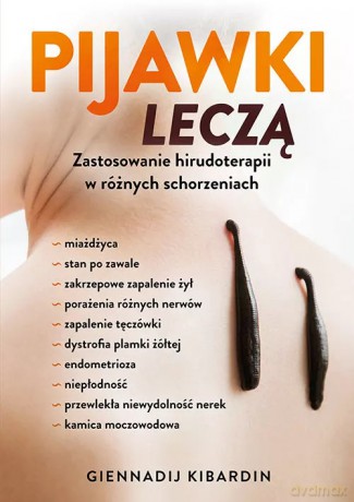 Pijawki leczą. Zastosowanie hirudoterapii w różnych schorzeniach - Kibardin Giennadij [KSIĄŻKA]