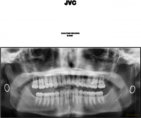 Jack Van Cleaf: JVC [2xWinyl]