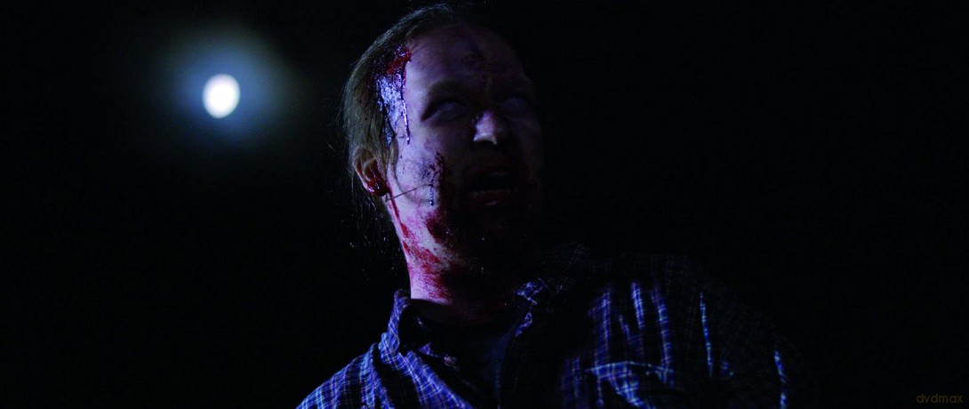 The Trees have Eyes [Blu-Ray]