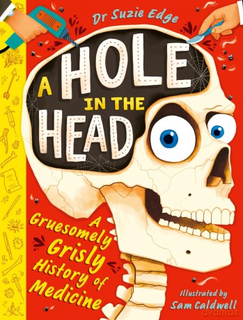 A Hole in the Head: A gruesomely grisly history of medical firsts - Suzie Edge [KSIĄŻKA]