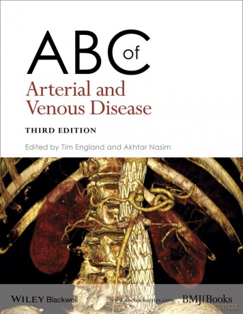 ABC of Arterial and Venous Disease, 3rd Edition - Tim England [KSIĄŻKA]