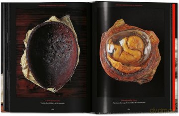 Anatomical Waxes. 45th Ed. - Marta Poggesi [KSIĄŻKA]