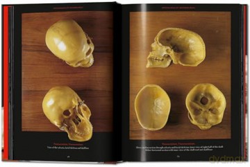 Anatomical Waxes. 45th Ed. - Marta Poggesi [KSIĄŻKA]
