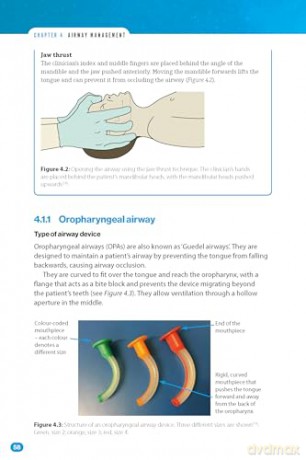 Bare Bones Anaesthesia: A Guide for Medical Students - Adam Arshad [KSIĄŻKA]
