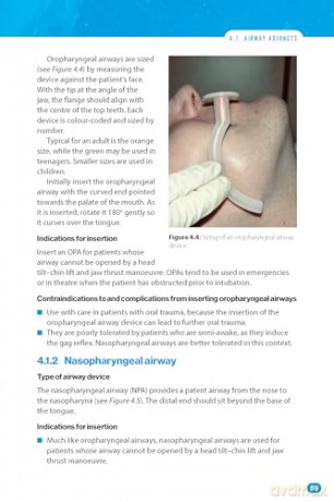 Bare Bones Anaesthesia: A Guide for Medical Students - Adam Arshad [KSIĄŻKA]