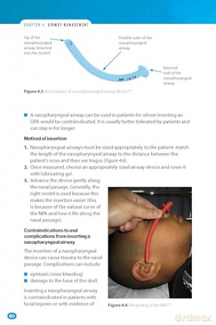 Bare Bones Anaesthesia: A Guide for Medical Students - Adam Arshad [KSIĄŻKA]