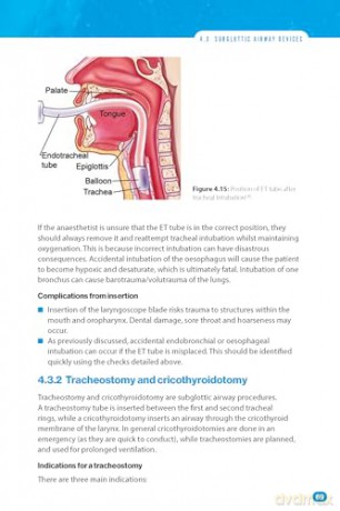 Bare Bones Anaesthesia: A Guide for Medical Students - Adam Arshad [KSIĄŻKA]