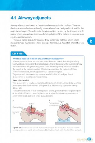 Bare Bones Anaesthesia: A Guide for Medical Students - Adam Arshad [KSIĄŻKA]