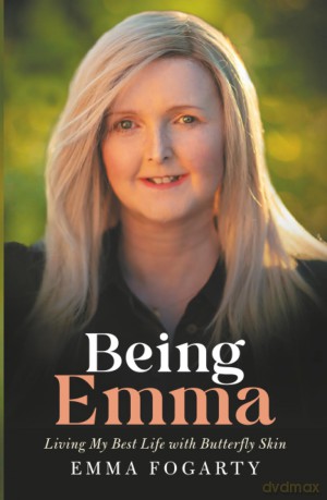 Being Emma: Living My Best Life with Butterfly Skin - Emma Fogarty [KSIĄŻKA]