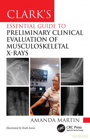 Clark's Essential Guide to Preliminary Clinical Evaluation of Musculoskeletal X-rays: Evaluating and Commenting on Images - Amanda Martin [KSIĄŻKA]
