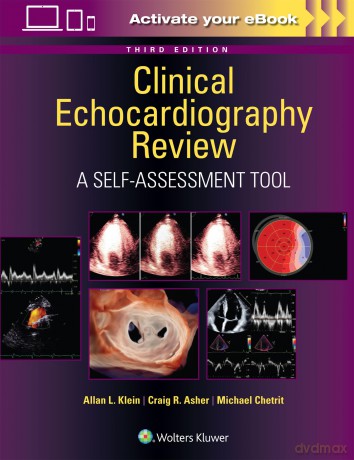 Clinical Echocardiography Review: A Self-Assessment Tool: Print + eBook with Multimedia - Allan L. Klein [KSIĄŻKA]